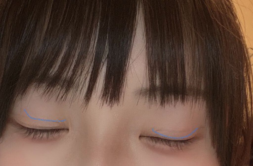 理想のふたえ ぱっちり幅広 ヌーディーワイド/セリア/二重まぶた用アイテムを使ったクチコミ（2枚目）