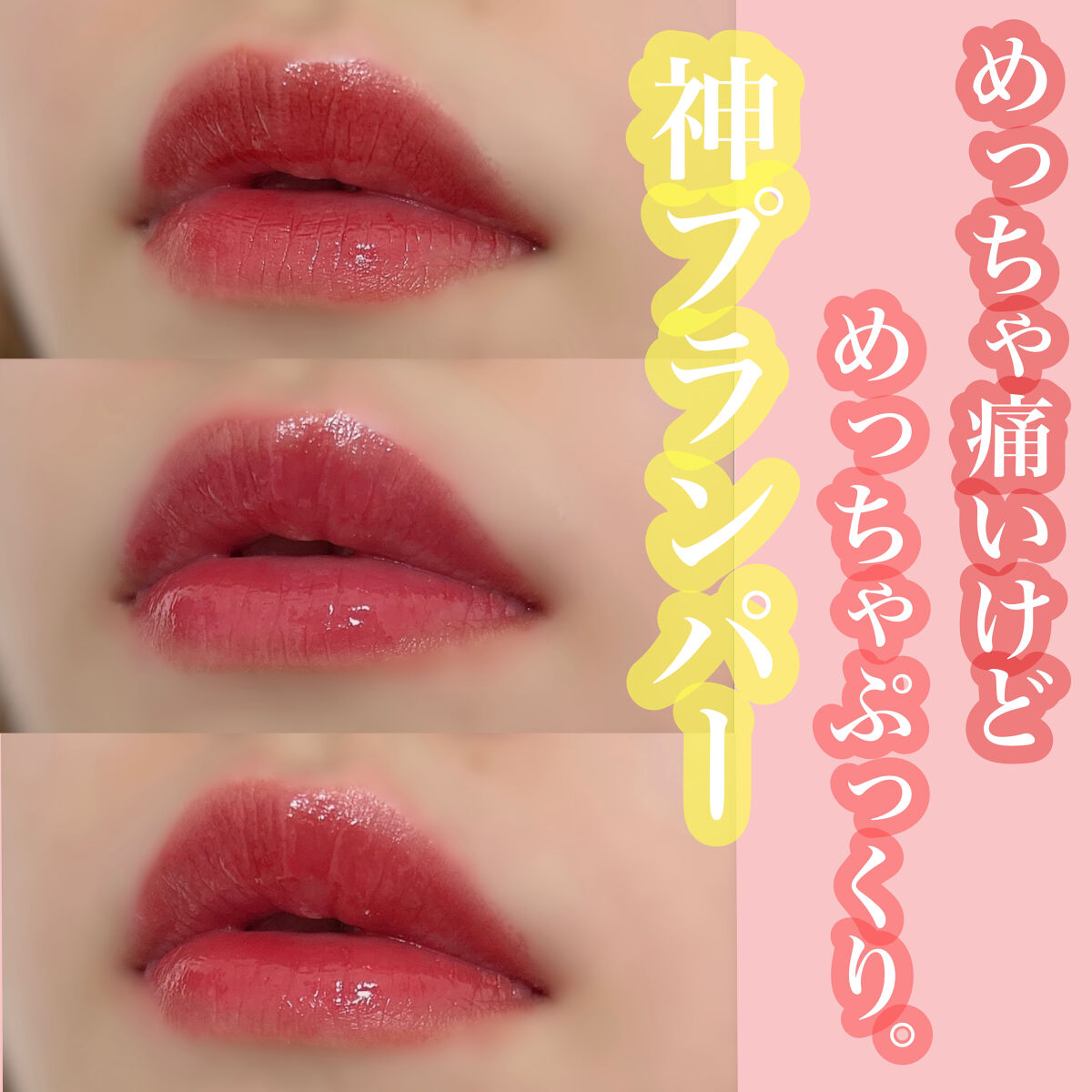 ドトムリッププラスプランパー/keybo/リッププランパーを使ったクチコミ（1枚目）