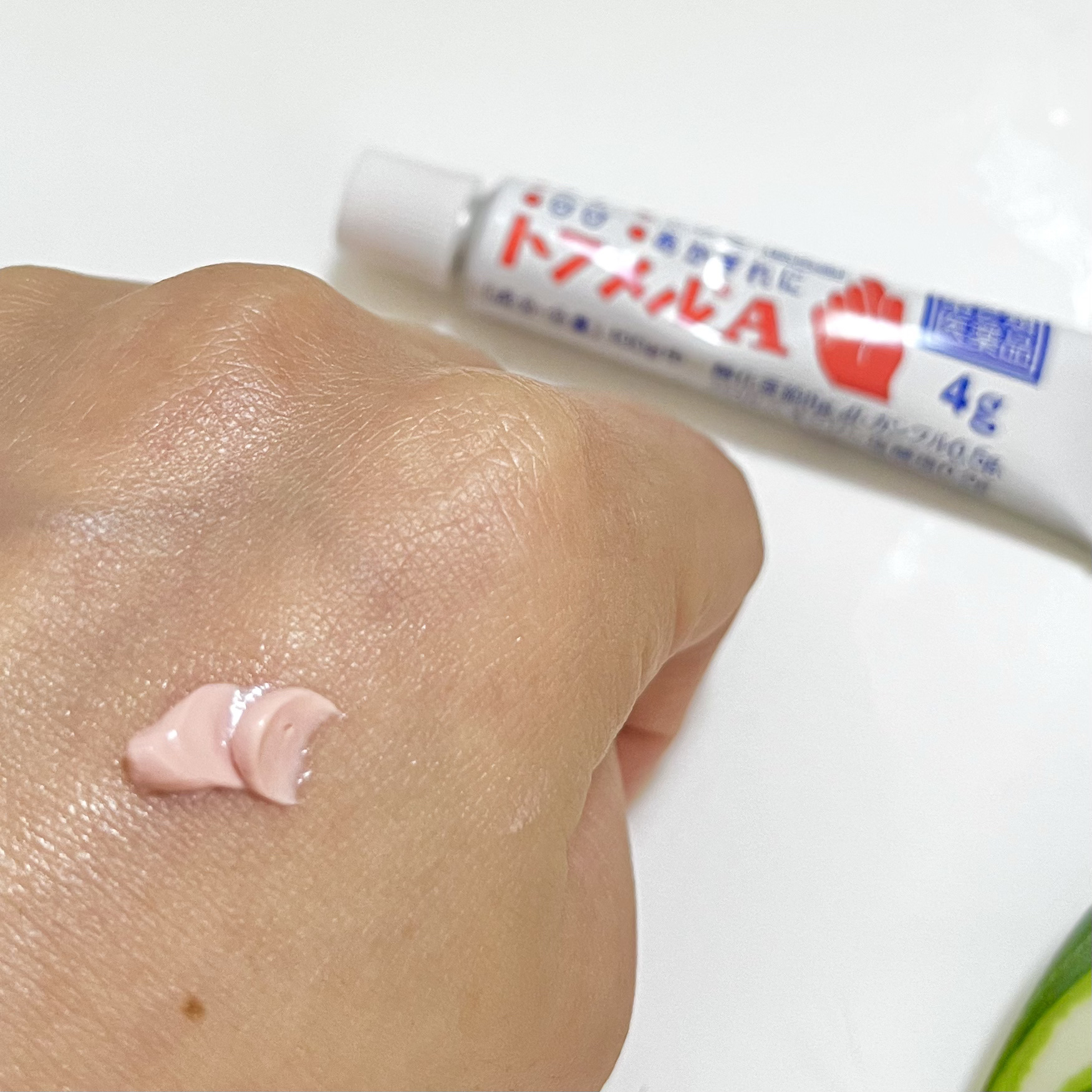 トフメルA（医薬品）/三宝製薬/その他を使ったクチコミ（2枚目）