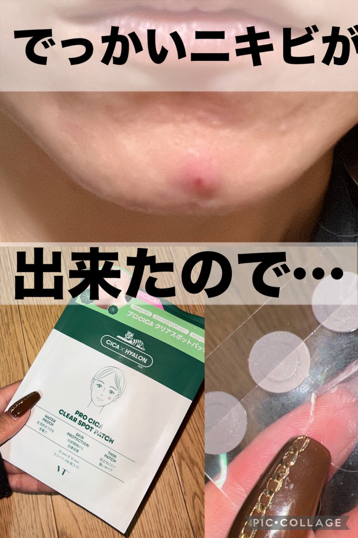 プロCICA クリアスポットパッチ/VT/その他スキンケアを使ったクチコミ(1枚目)