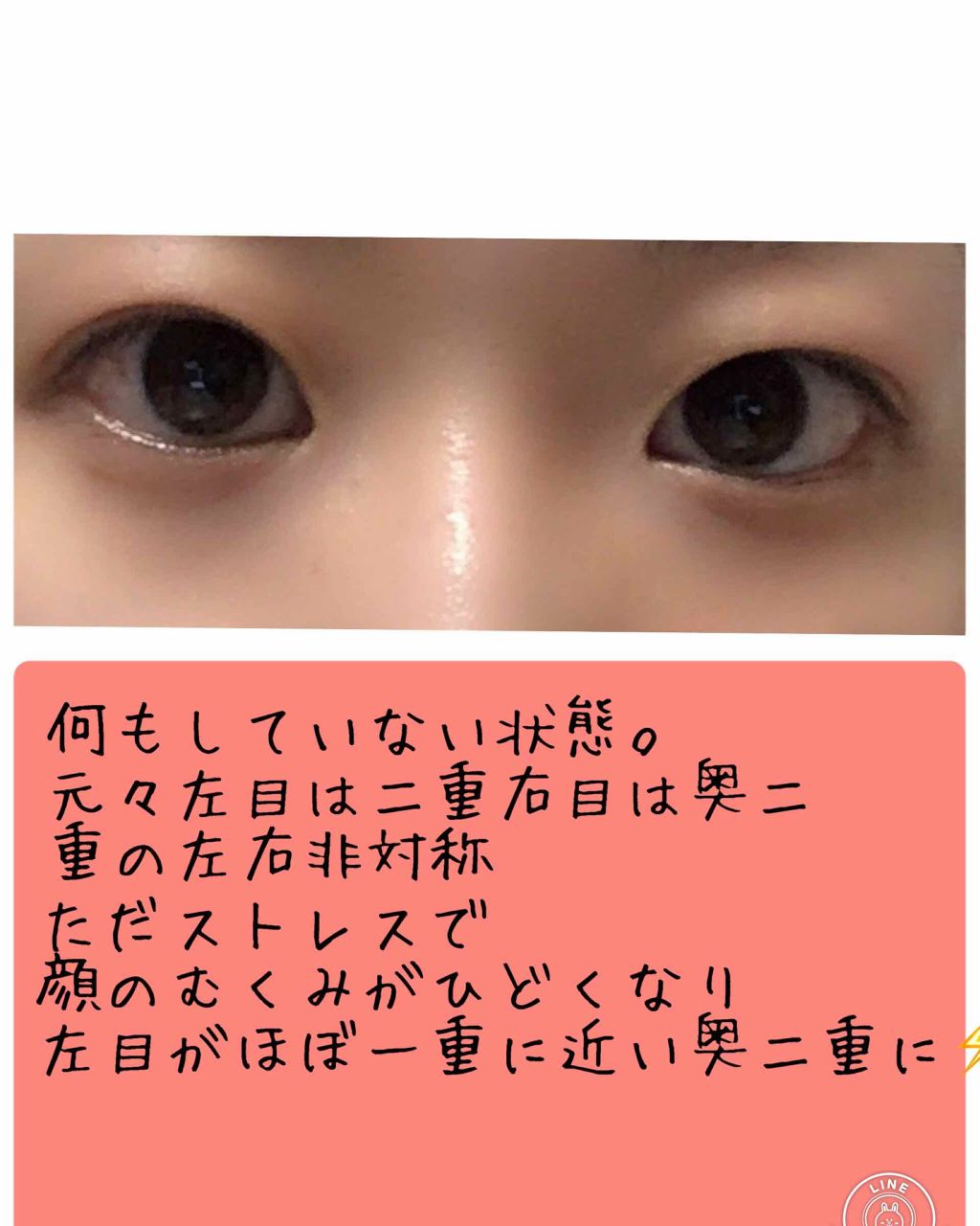 ナイトアイボーテ Streetrendの使い方を徹底解説 ナイトアイボーテレポ 元々目が左右非対称 By にゃー 混合肌 代後半 Lips