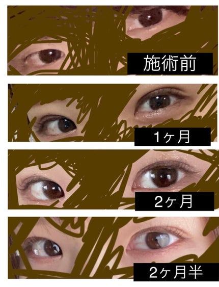 äºéæŽåœ¢/ãã®ä»ã䜿ã£ãã¯ãã³ãïŒ2æç®ïŒ