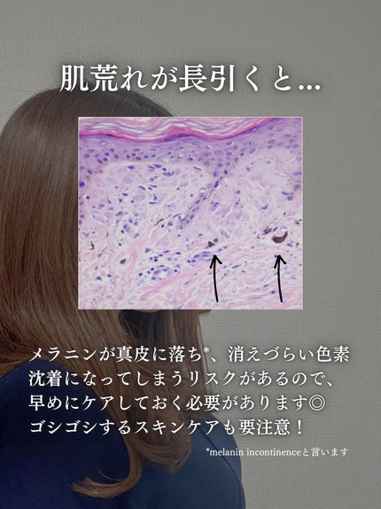 洗顔用泡立てネット/無印良品/その他スキンケアグッズを使ったクチコミ(9枚目)