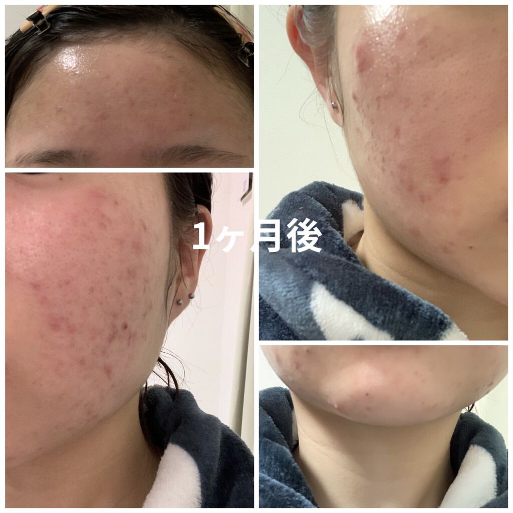 モイスト アプローチ/MARY QUANT/美容液を使ったクチコミ（2枚目）