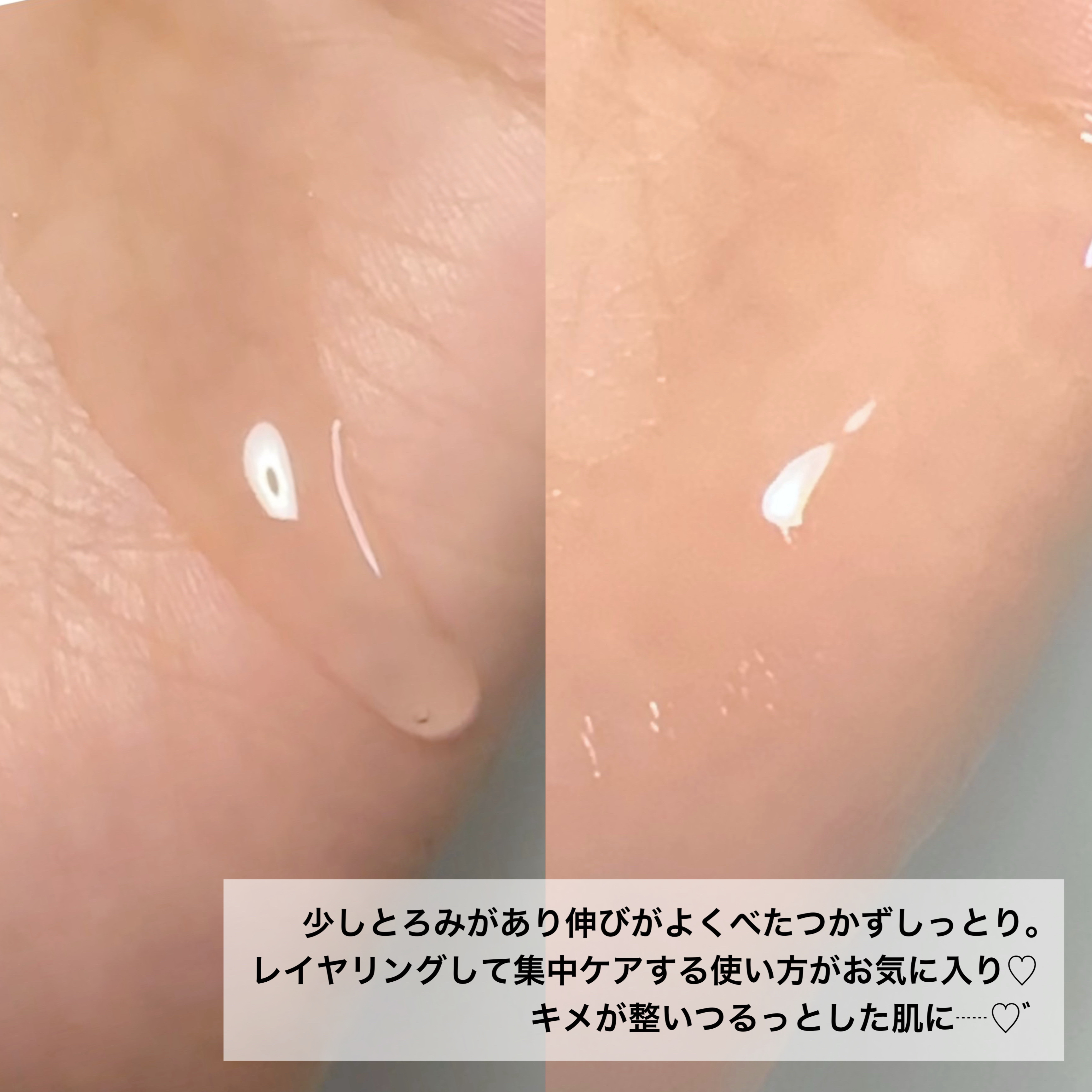 イチジク毛穴アンプル/Veganifect/美容液を使ったクチコミ（3枚目）