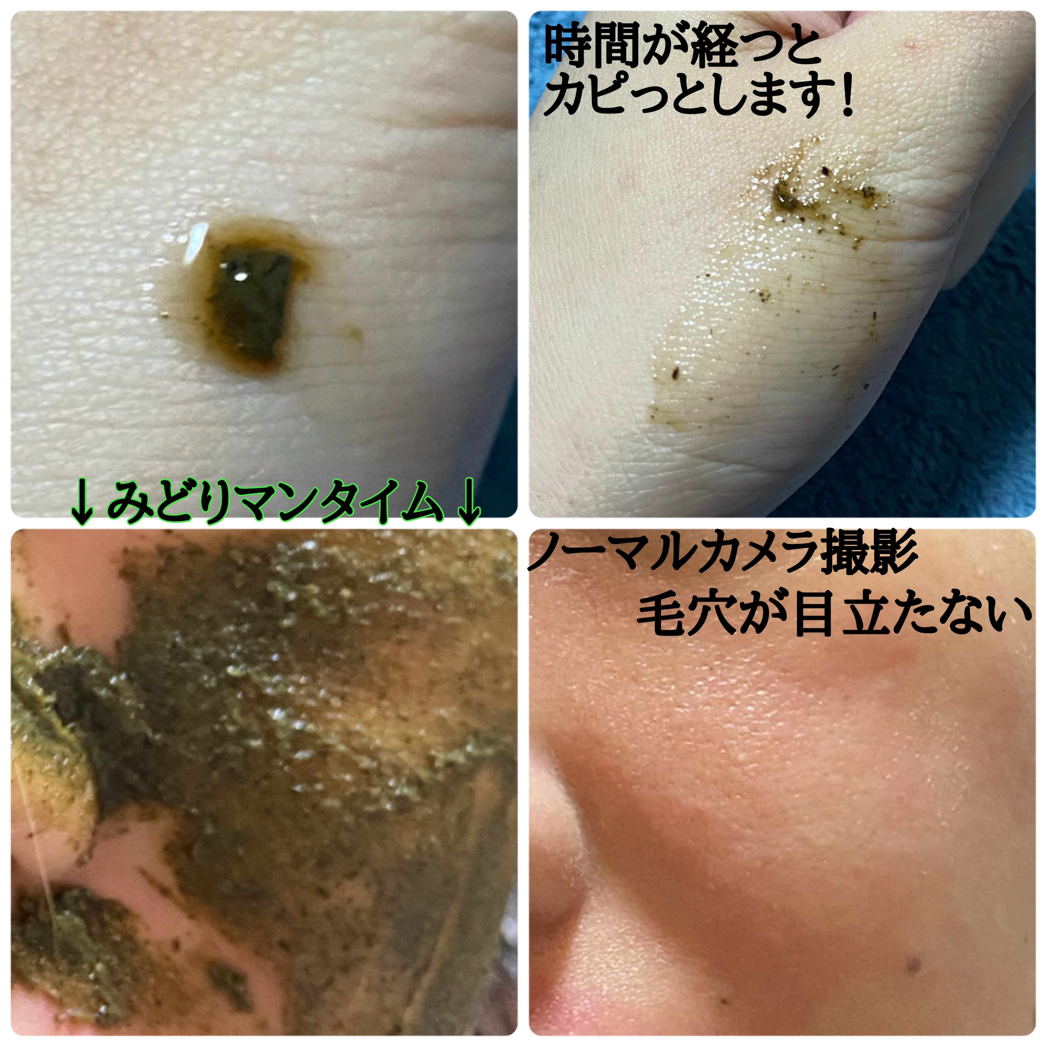 ティーツリーハーブピーリングパック/WellDerma/洗い流すパック・マスクを使ったクチコミ（2枚目）