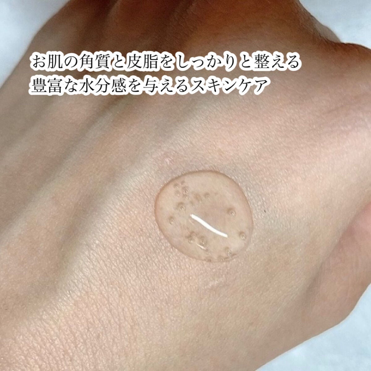 ドクダミカーミングタッチスポットパッド/Abib /トナーパッドを使ったクチコミ(7枚目)