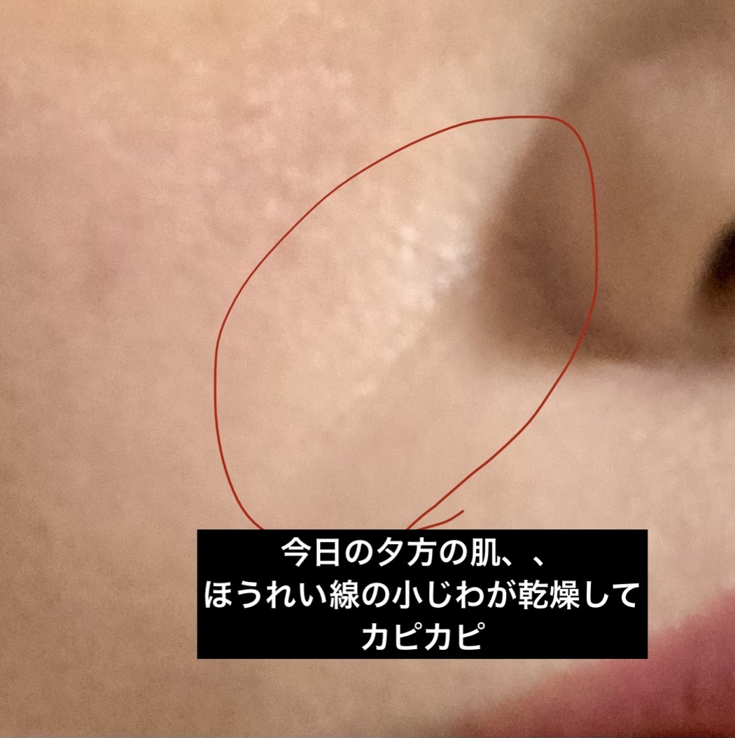 薬用デイエッセンスバーム/TIME SECRET/美容液を使ったクチコミ（3枚目）