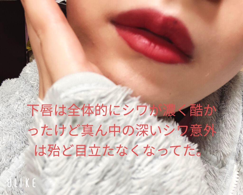 LIPS SHOT/MOTTO LAB./リップマスクを使ったクチコミ(2枚目)