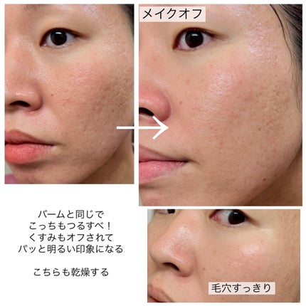 バランシング クレンジング オイル N/THREE/オイルクレンジングを使ったクチコミ(7枚目)