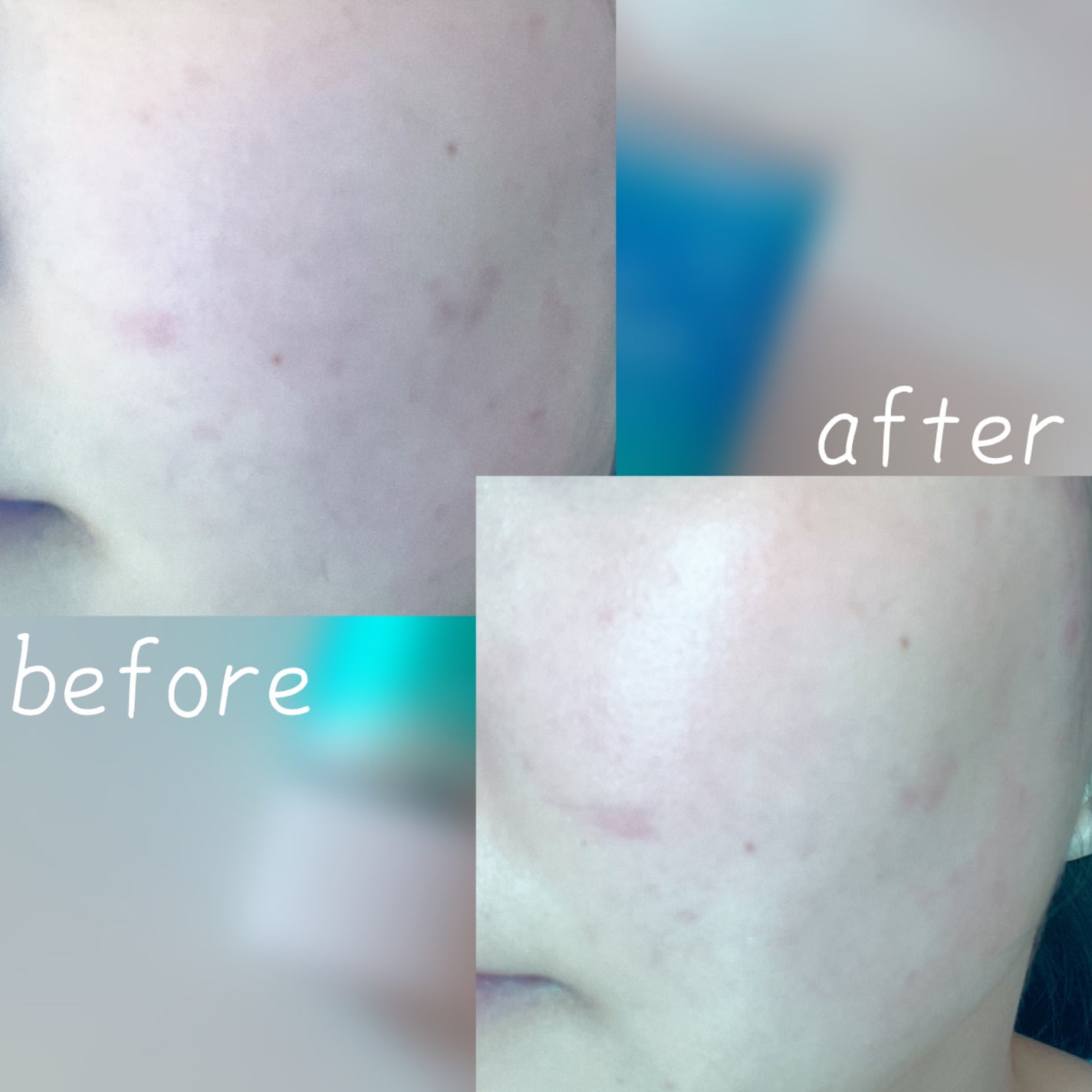 スキンアクア トーンアップUVエッセンス/スキンアクア/日焼け止めクリームを使ったクチコミ(4枚目)