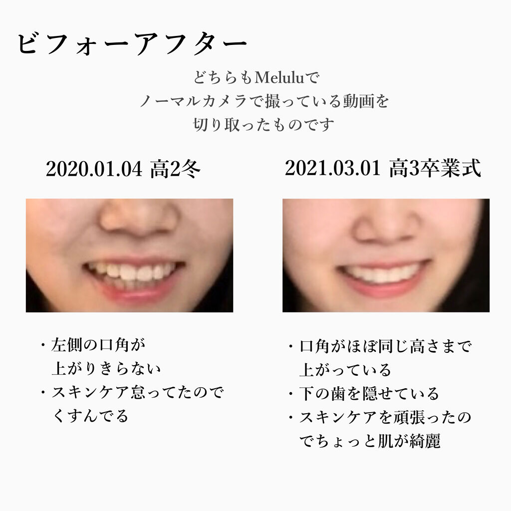 を使ったクチコミ（3枚目）