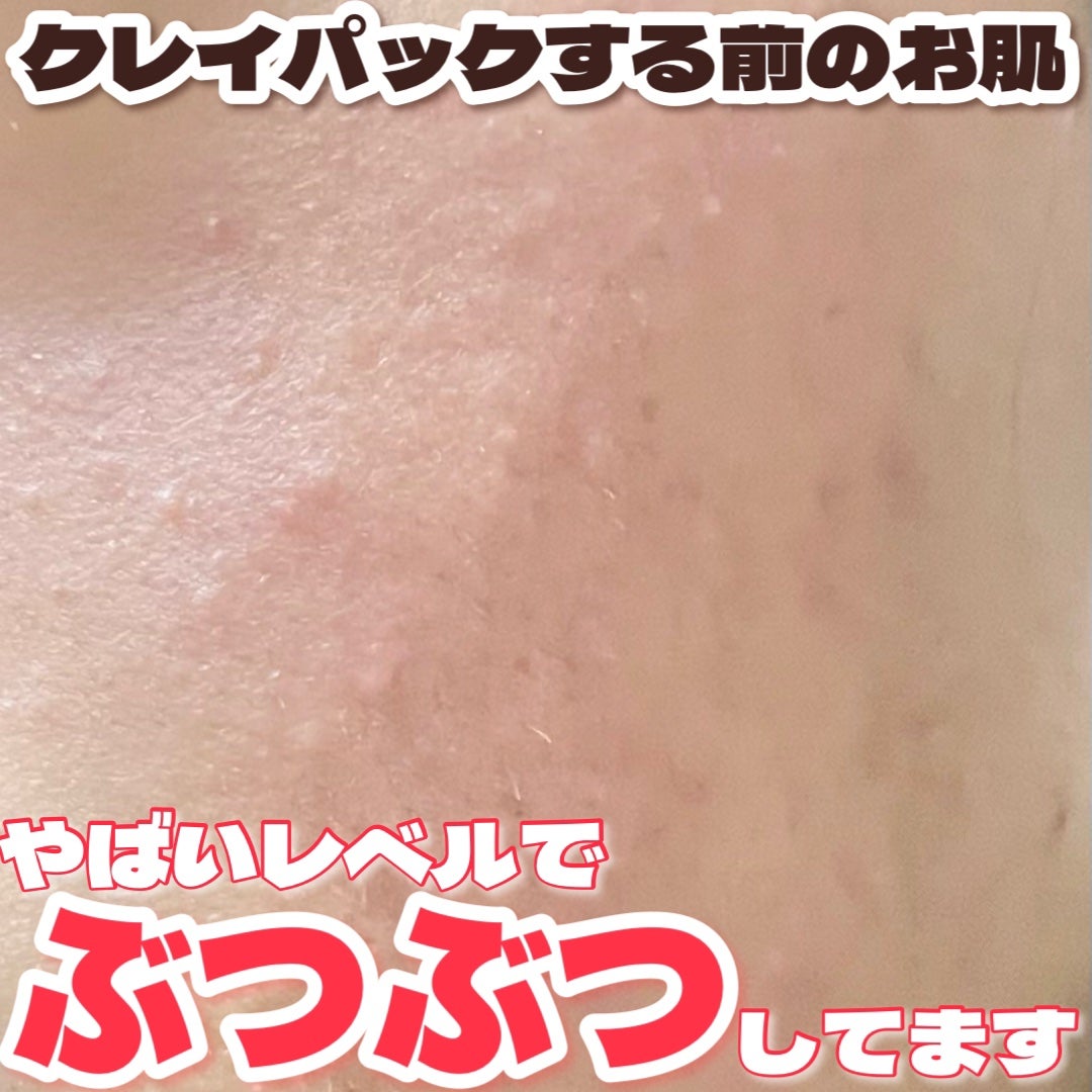 スーパーヴォルカニック ポア クレイマスク/innisfree/洗い流すパック・マスクを使ったクチコミ(3枚目)