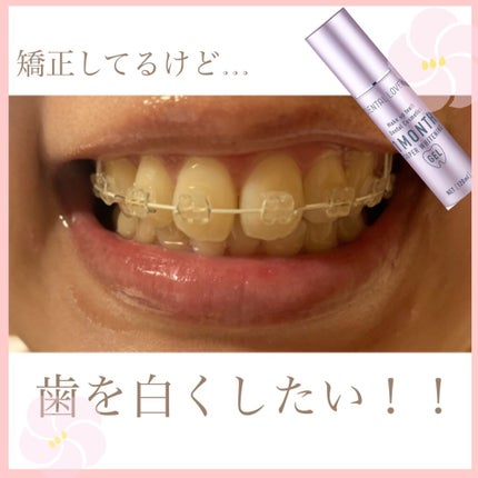 スーパーホワイトニングゲル/デンタルラバー/その他オーラルケアを使ったクチコミ(2枚目)