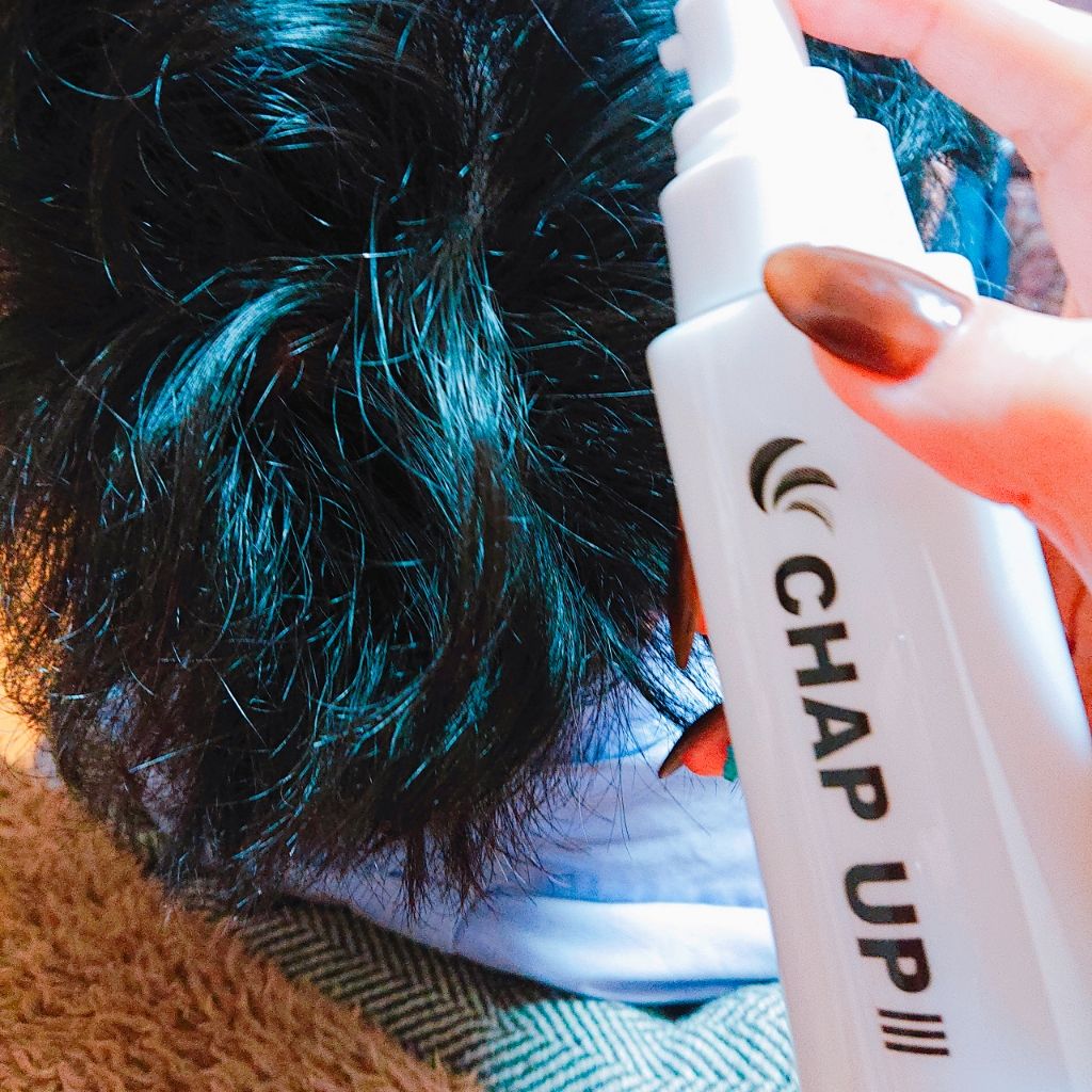 チャップアップ育毛ローション/CHAP UP(チャップアップ)/頭皮ローションを使ったクチコミ(1枚目)