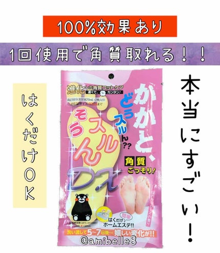 かかと どうスルん??そうスルんDX/Stay Free/レッグ・フットケアを使ったクチコミ(1枚目)