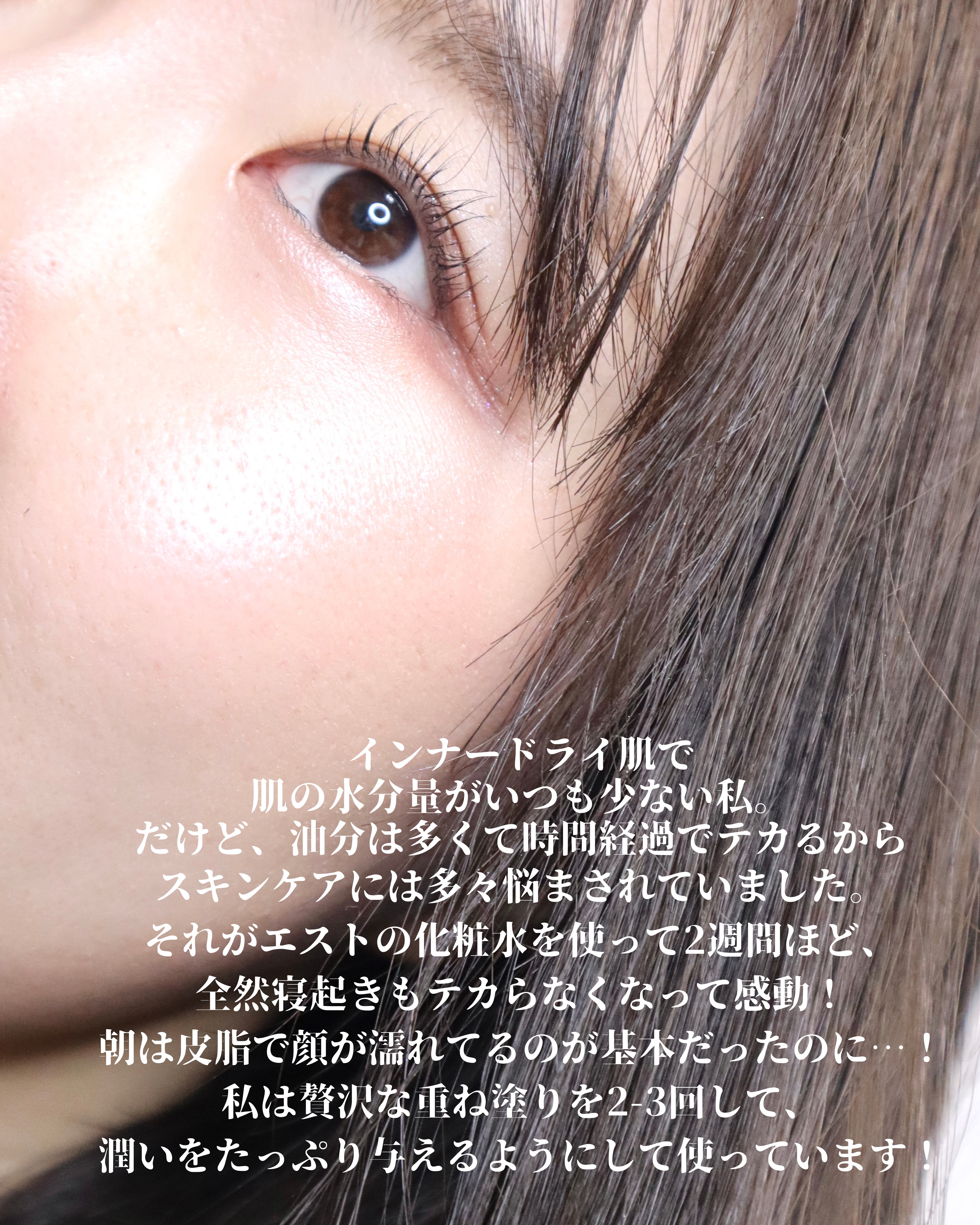 エスト ザ ローション/est/化粧水を使ったクチコミ（3枚目）