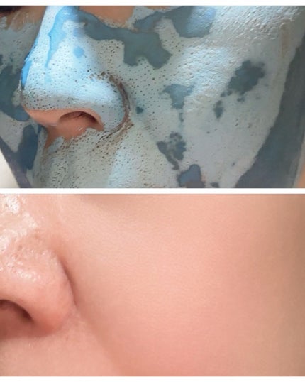 ゼロ毛穴クレイパック/MEDICUBE/洗い流すパック・マスクを使ったクチコミ(5枚目)