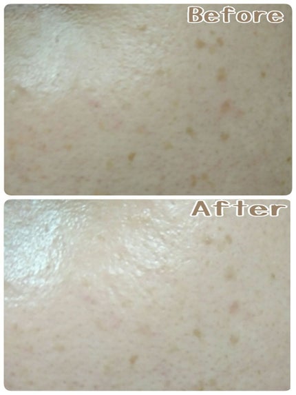 エリクシール ホワイト リセット ブライトニスト/エリクシール/フェイスクリームを使ったクチコミ(3枚目)