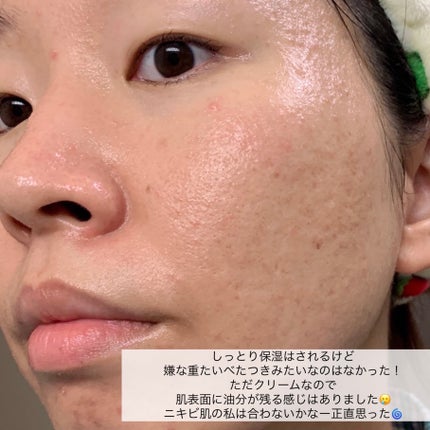 moisturizing sheet mask/ヴァセリン/シートマスク・パックを使ったクチコミ(5枚目)