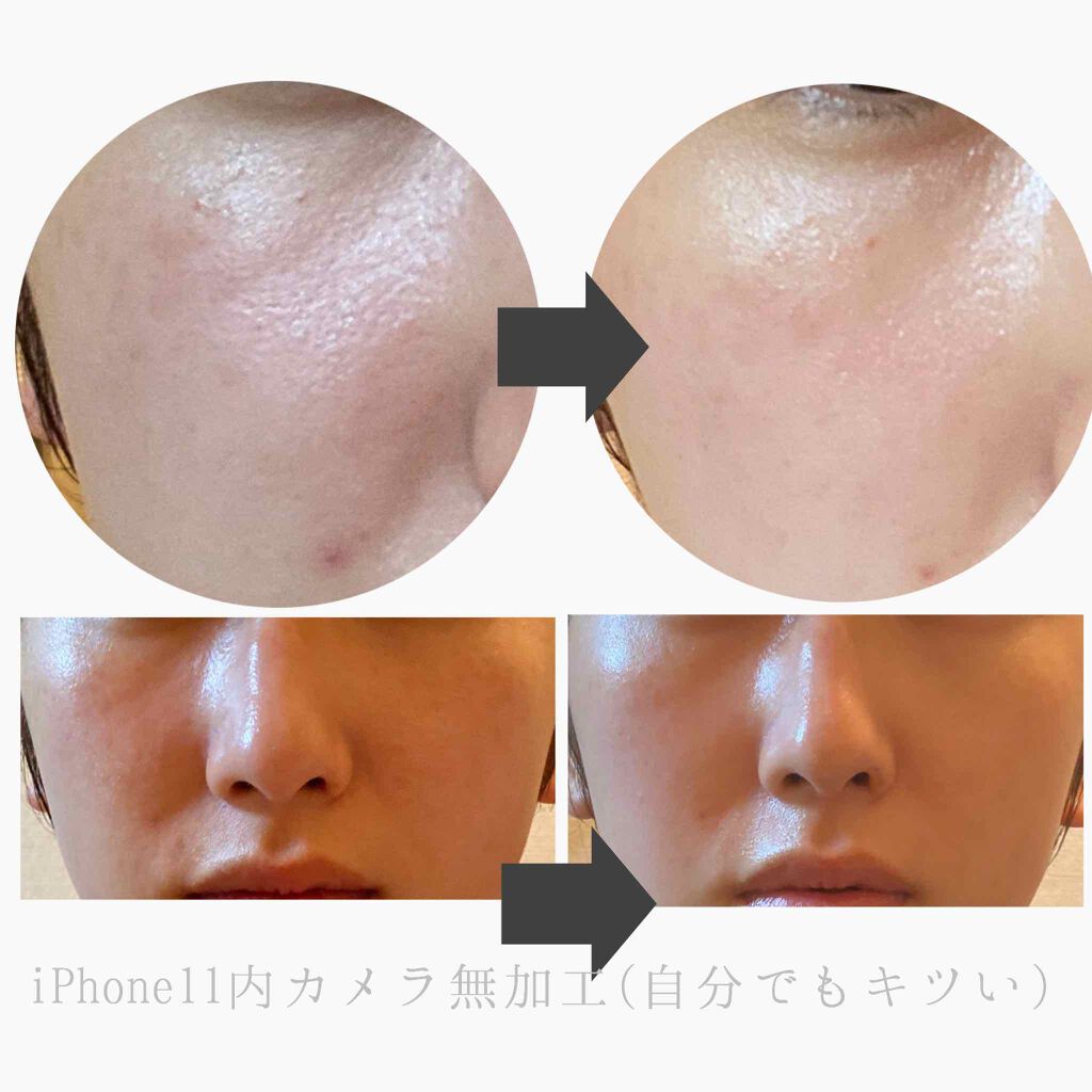 薬用しみ対策 保湿クリーム/メラノCC/フェイスクリームを使ったクチコミ（2枚目）