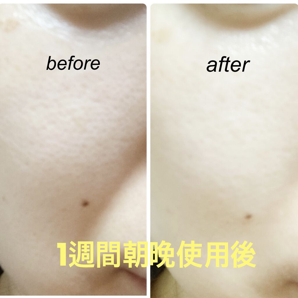 ガラクナイアシン2.0エッセンス/manyo/美容液を使ったクチコミ（3枚目）