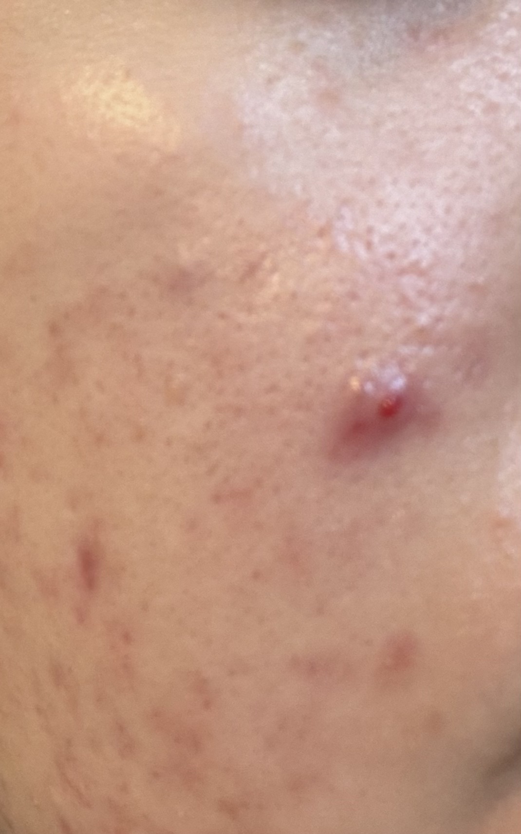 フェイスマスク 【しっかり実感30枚セット】/KISO/シートマスク・パックを使ったクチコミ（1枚目）