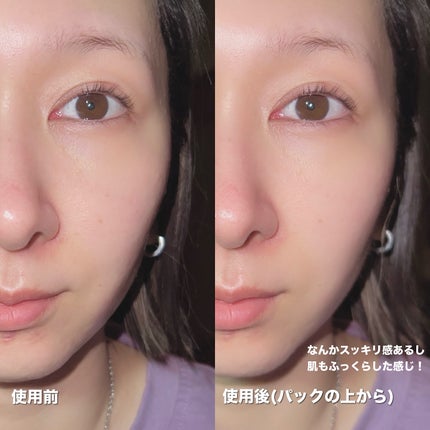 LifTone/アーリーバード/美顔器・マッサージを使ったクチコミ(7枚目)