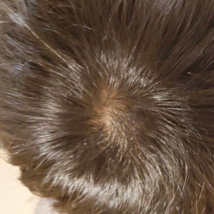 チャップアップ育毛ローション/CHAP UP(チャップアップ)/頭皮ローションを使ったクチコミ(4枚目)