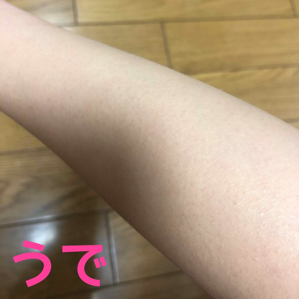 光美容器KE-NON(ケノン)/エムテック/家庭用脱毛器を使ったクチコミ(2枚目)