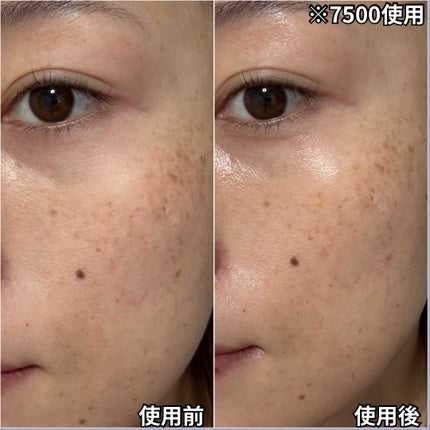 ゼロ1DAYエクソソームショット7500/MEDICUBE/美容液を使ったクチコミ(3枚目)