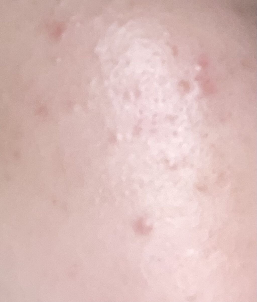 潤浸保湿 化粧水 III とてもしっとり/キュレル/化粧水を使ったクチコミ（2枚目）