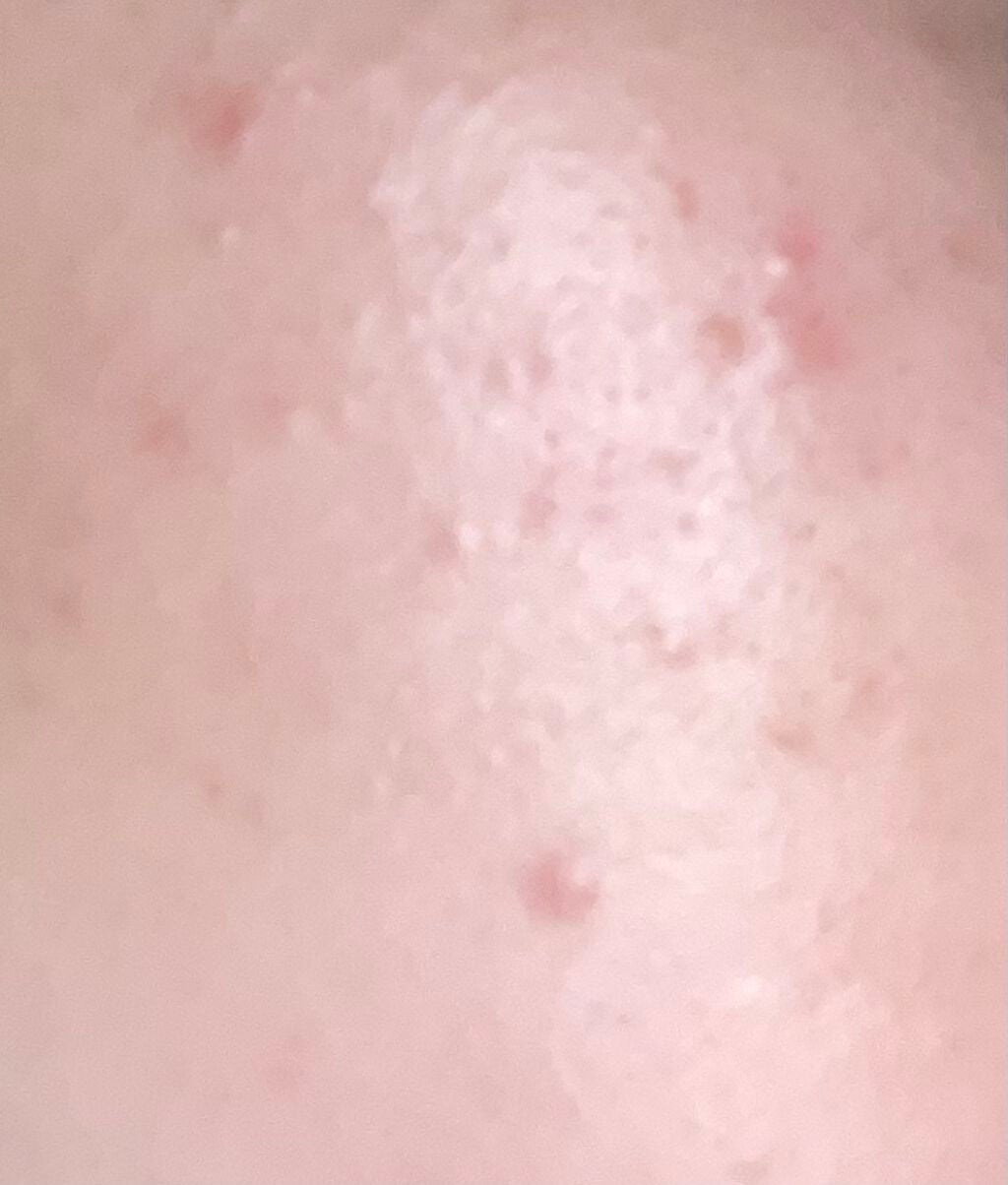 潤浸保湿 化粧水 III とてもしっとり/キュレル/化粧水を使ったクチコミ(2枚目)