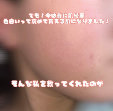 メンソレータム アクネス 薬用ふわふわな泡洗顔のクチコミ「ニキビに悩んでるならこの洗顔を買え

プチプラなのに効果抜群！

今までニキビに効く洗顔使って.....」（3枚目）