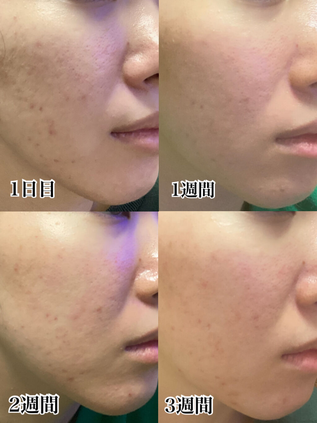  HOTARU PERSONALIZED LOTION／MOISTURIZER /HOTARU PERSONALIZED/スキンケアキットを使ったクチコミ（3枚目）