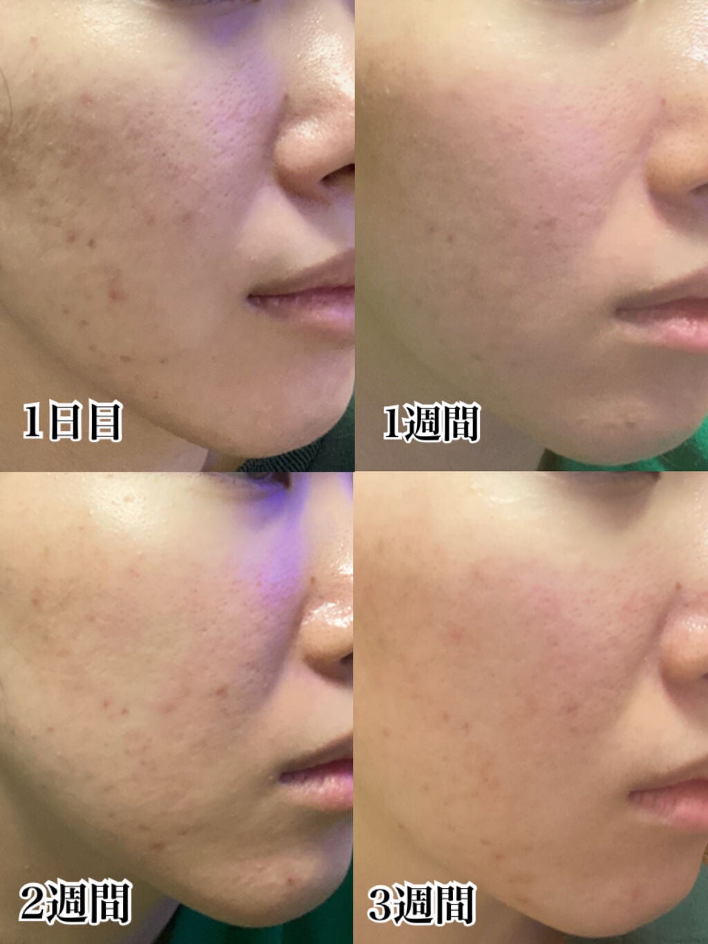 HOTARU PERSONALIZED LOTION/MOISTURIZER /HOTARU PERSONALIZED/スキンケアキットを使ったクチコミ(3枚目)