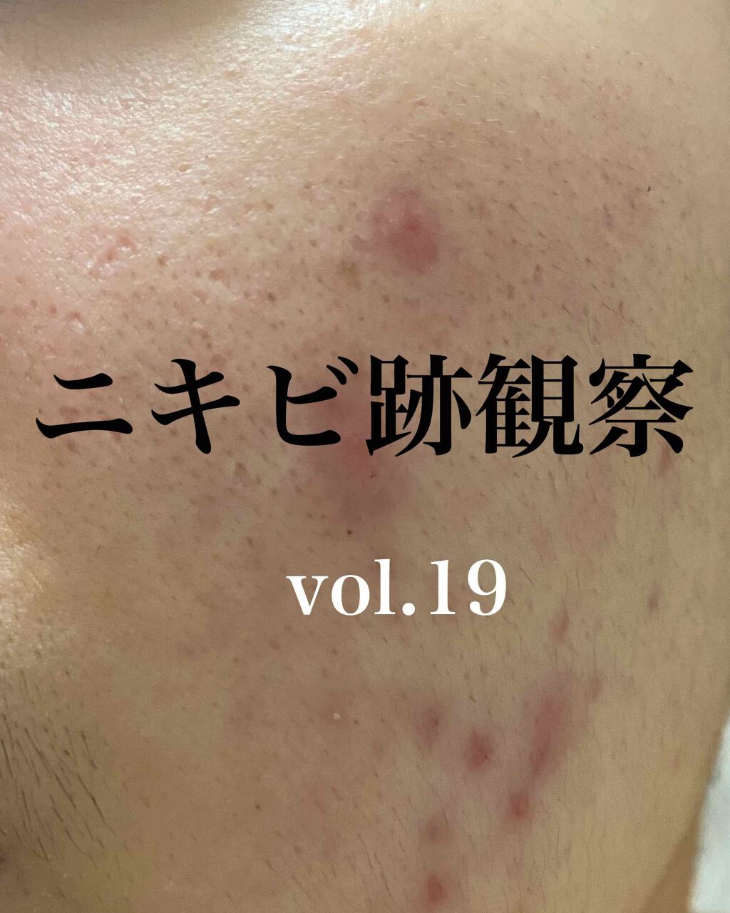 Cセラム/b.glen/美容液を使ったクチコミ（1枚目）