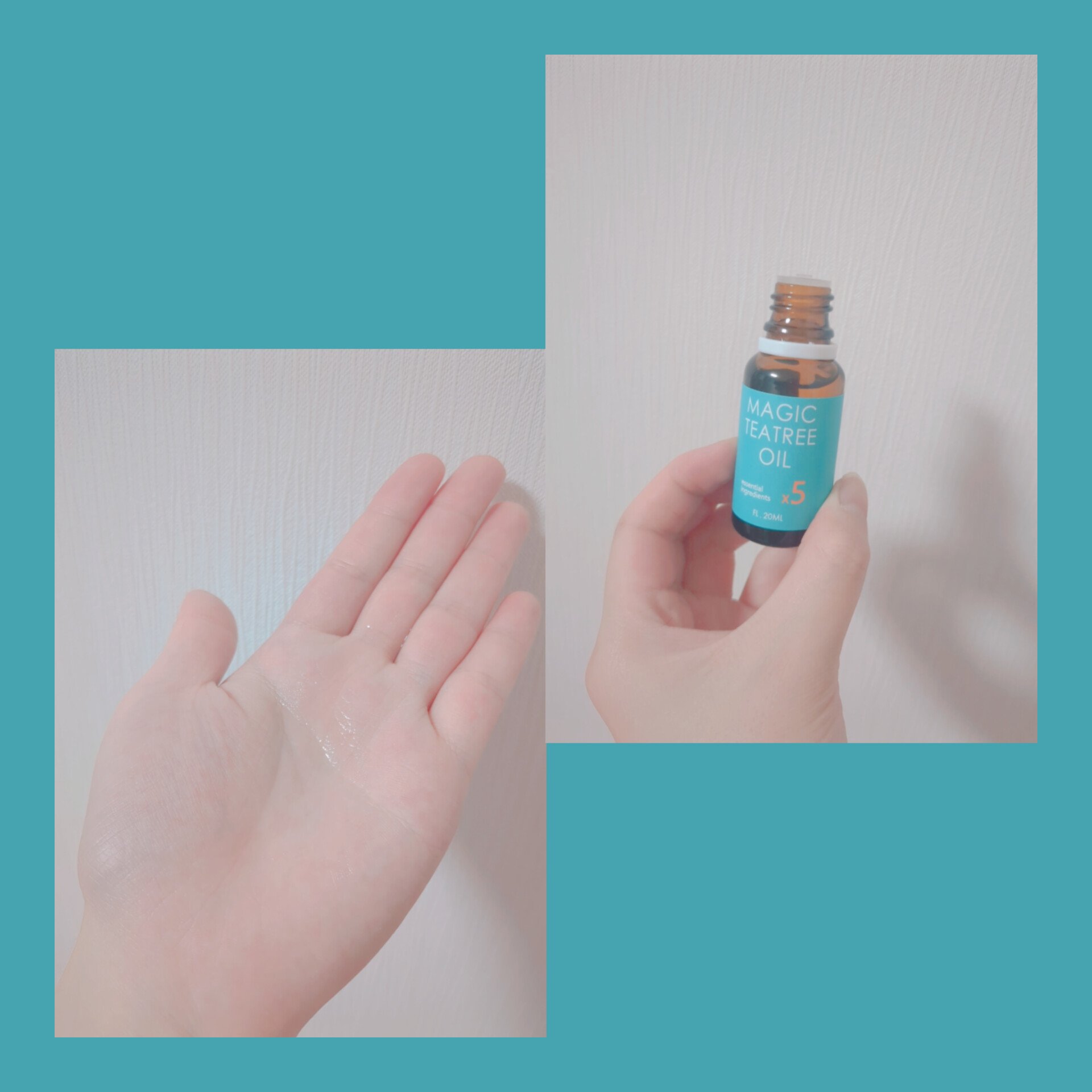 マジックティーツリーオイル/ブラン/フェイスオイルを使ったクチコミ（2枚目）