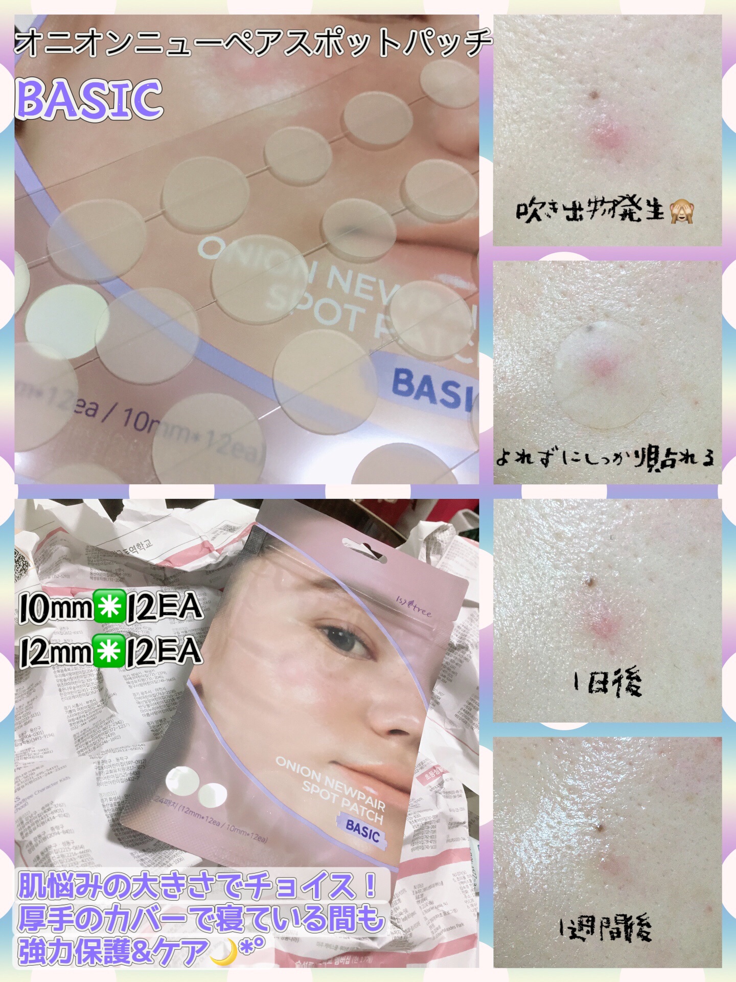 Isntree オニオン ニューペア スポットパッチ ベーシックのクチコミ「イズエンツリー (@isntree_jp )
オニオンニューペアスポットパッチ💜


吹き出物.....」（2枚目）