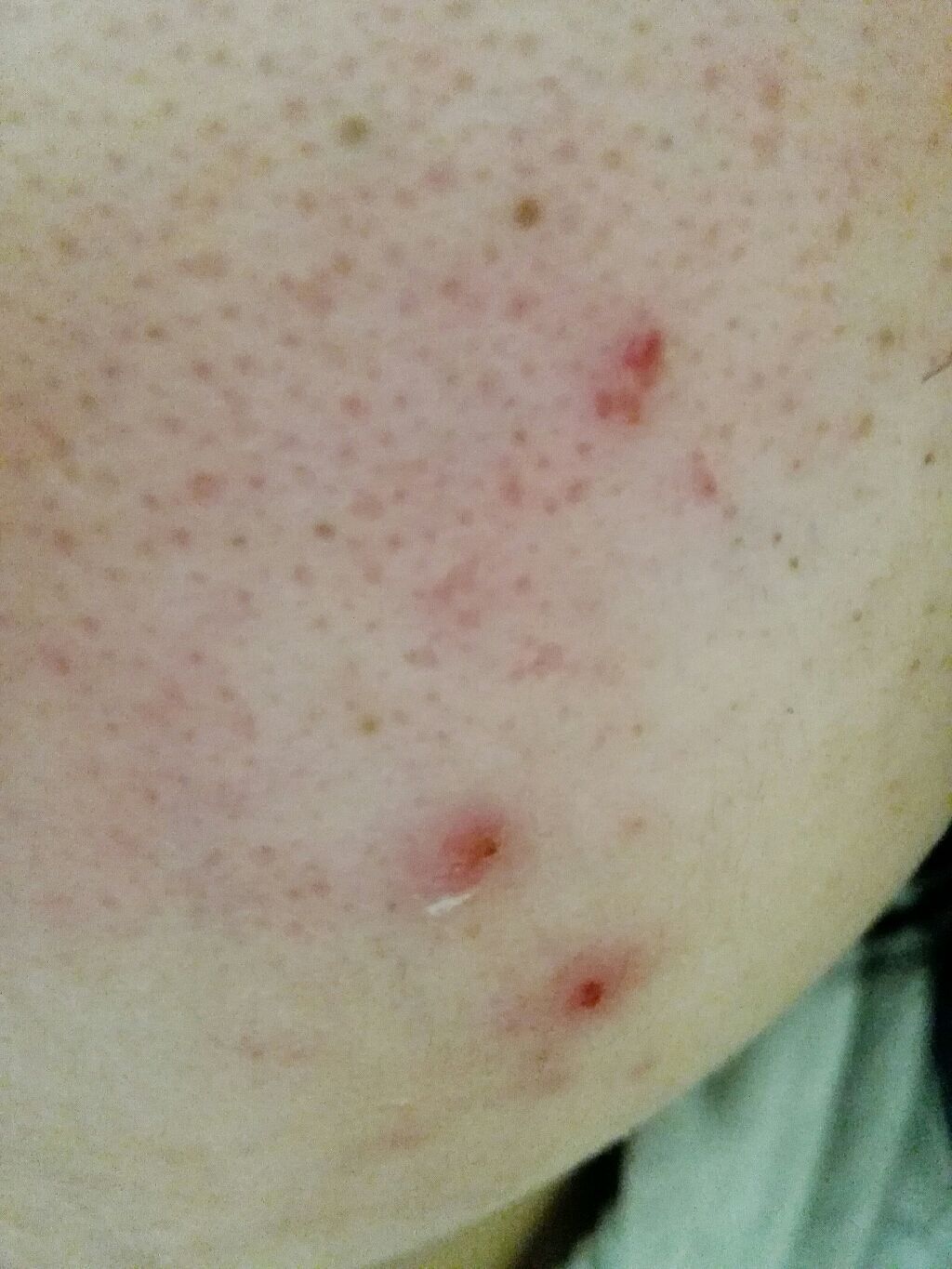 カラーコンシーラー/セラフォア/リキッドコンシーラーを使ったクチコミ(2枚目)