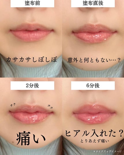 リードルS リッププランパーエキスパート/VT/リッププランパーを使ったクチコミ(4枚目)