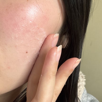 ブライトニングピーリングジェル/Dr.G/ピーリングを使ったクチコミ(4枚目)