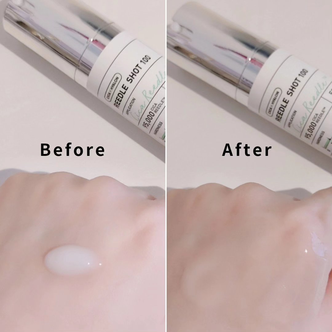 リードルショット100/VT/美容液を使ったクチコミ（3枚目）