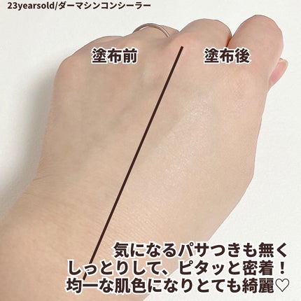 ダーマシンコンシーラー/23years old/リキッドコンシーラーを使ったクチコミ(3枚目)