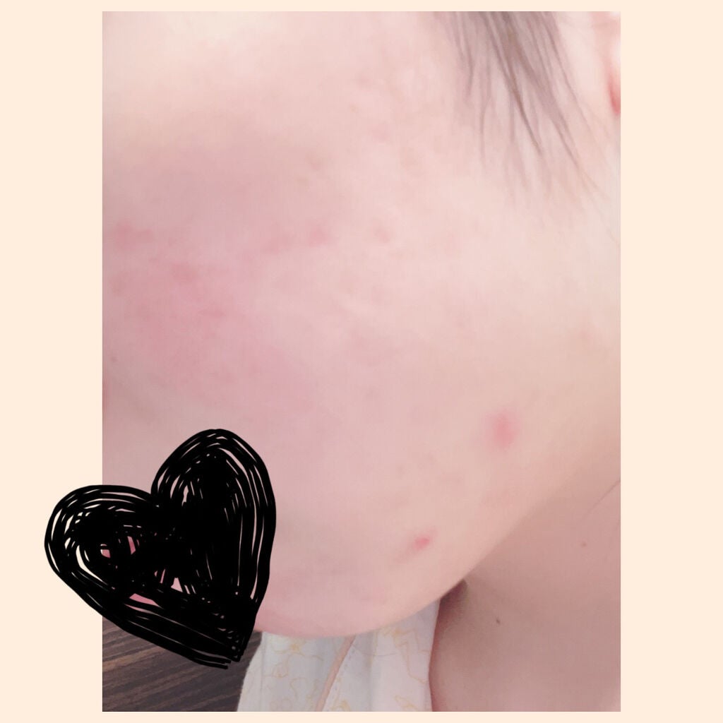 ジンジャーハニー モイストスキン/innisfree/化粧水を使ったクチコミ(5枚目)