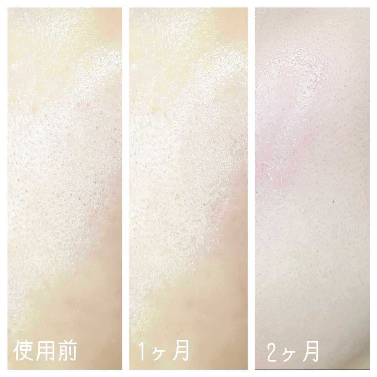 ã¡ãð€ãã©ãã100ð» on LIPS ãâ¡â¡â¡@vtcosmetics_japanæ§ããçŸå®¹æ¶²ãšããã¯..ãïŒ4æç®ïŒ