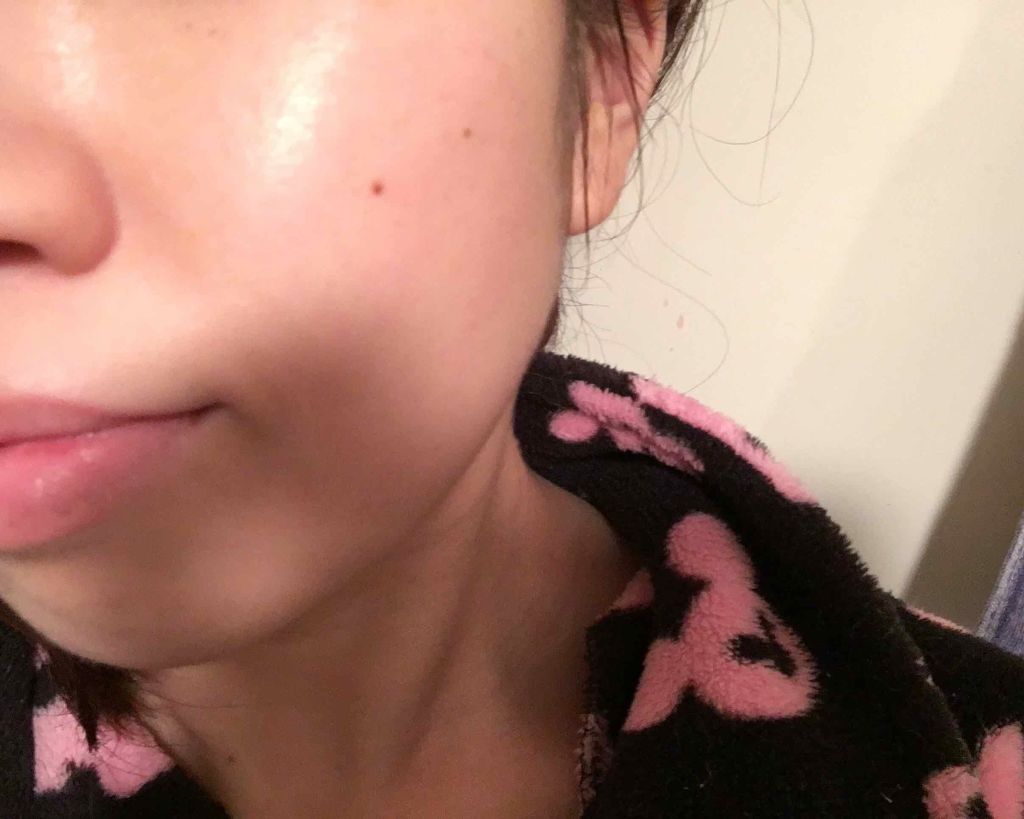 モイスチャー クリアソープ/アルージェ/洗顔石鹸を使ったクチコミ（2枚目）