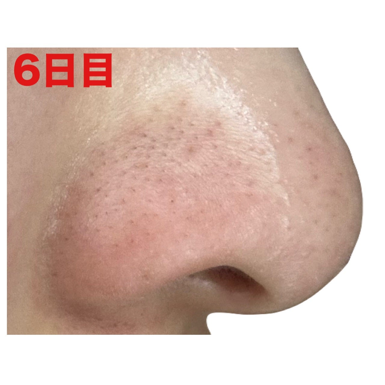 3番 緑茶炭毛穴パッククレンジングバーム/numbuzin/クレンジングバームを使ったクチコミ(9枚目)