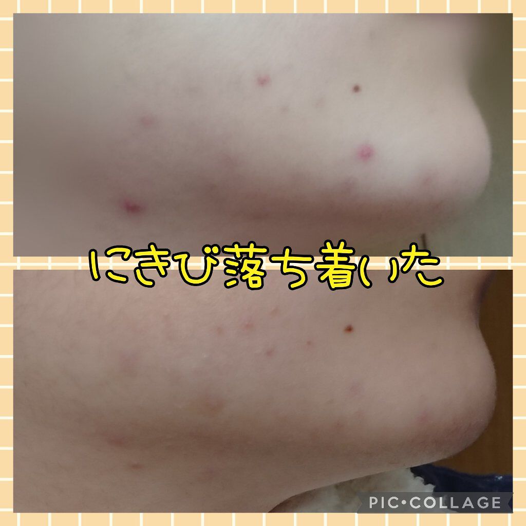 アスタリフト ホワイト ジェリー アクアリスタ/アスタリフト/美容液を使ったクチコミ（1枚目）