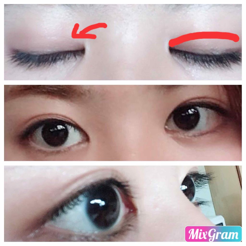 ナチュラルアイトークN/アイトーク/二重まぶた用アイテムを使ったクチコミ(1枚目)